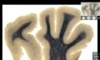 Download Einstein's brain image