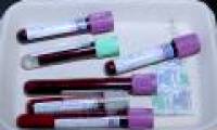 Early detection of ovarian cancer thanks to regular blood tests
