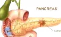 Early detection of pancreatic cancer and bile cancer