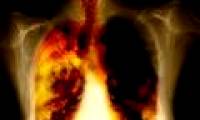 Early screening for lung cancer