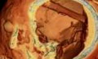 Egyptian mummies forgot the tools in the dead man's brain