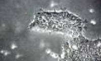 Evidence of the existence of cancer stem cells