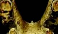 Evidence shows that the ancients knew how to use toothpicks to