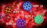 Factors that increase the risk of cervical cancer