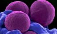 Find a way to kill bacteria in a completely new body
