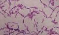 Find the key of immortality from bacteria living 3.5 million years ago