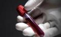 Find the safest cancer test method ever