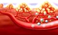 Find the secret why cancer cells are resistant to drugs