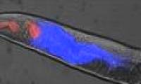 Finding out the mechanism of death of the roundworm, we will take a step closer to immortality