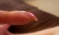 Fingernails overlap warn lung cancer