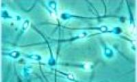 First created artificial sperm