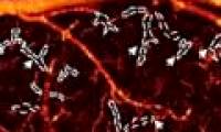 For the first time humans see the impact of drugs on the brain