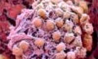For the first time successfully created stem cells from human skin