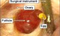 For the first time, the image of ovulation is recorded