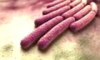 Forget sharks, these 5 bacteria also make you