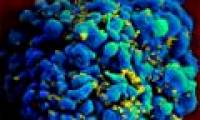 Found a vaccine for HIV?