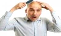 Found cells that cause baldness and silver hair