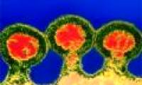 Found the 'pure' of the HIV virus