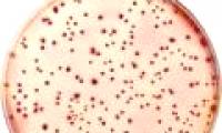 France discovered strange bacteria causing death in babies