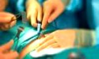Gastric ligation surgery helps treat type 2 diabetes