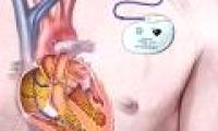Genetic detection increases the risk of atrial fibrillation