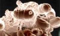 Genetically modified bacteria can prevent obesity