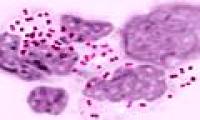 Gonorrhea spreads by oral sex