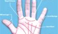 Hand surgery to change fate