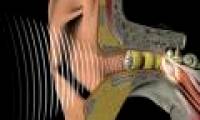 Hearing is associated with an increased risk of dementia