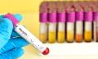 Herpes virus can lead to bipolar disorder and depression