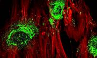 High-frequency sound waves turn stem cells into bone cells in just 5 days