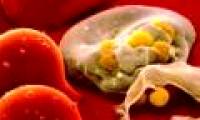 HIV virus can hide in the bone marrow