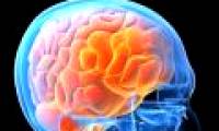HIV virus increases the proportion of patients with dementia