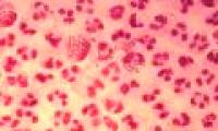 How dangerous is gonorrhea?