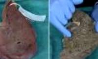 How does beer devastate your liver?