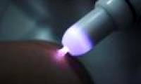 How does cold plasma support healing open wounds?