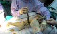 How does leg lengthening surgery work?
