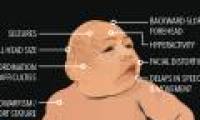 How is Zika virus raging in human history?