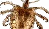 How to prevent pubic lice - Insects cling to 'closed areas'