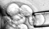 Human embryo production from genes of 3 people