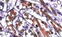 IAEA uses nuclear technology against H5N1 virus