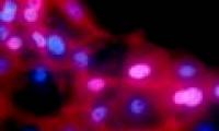 Image of cancer cells under a microscope