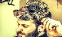 Implant SoC chips into human brain to treat disease