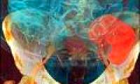 Important breakthrough by identifying 20 genes in the kidney
