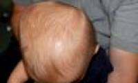 Infant's head: what mom should know!