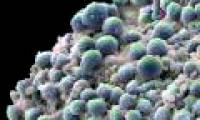 Infertile men are more likely to develop adenocarcinoma