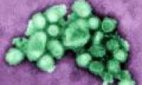 Influenza A / H1N1 and its relationship with arsenic exposure at common levels