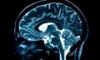 Ion Magie can help maintain long-term memory mechanism