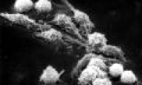 Is EBV virus the cause of cancer?