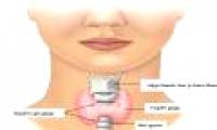 Israel breakthrough in method for detecting thyroid cancer